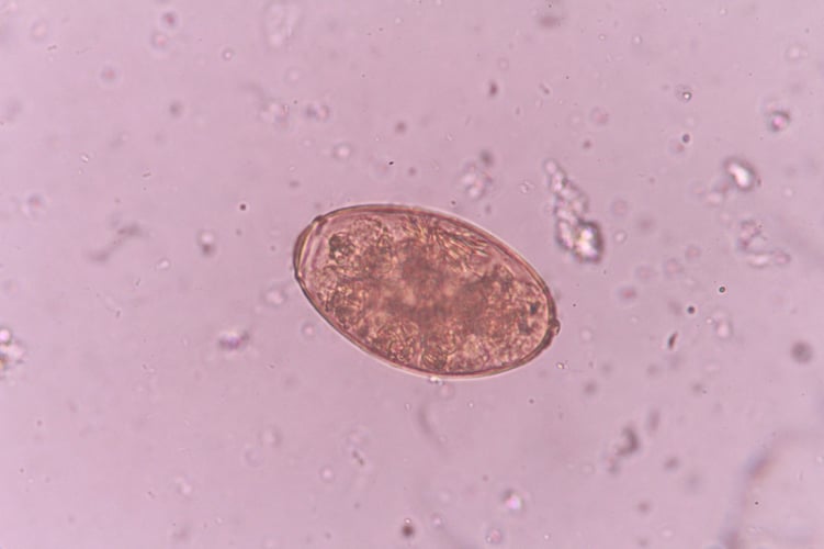 Fasciola hepatica vista desde un microscopio