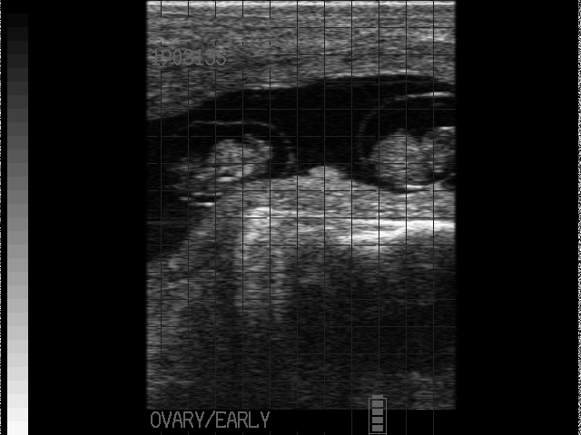 Ultraschall von Zwillingskälbern