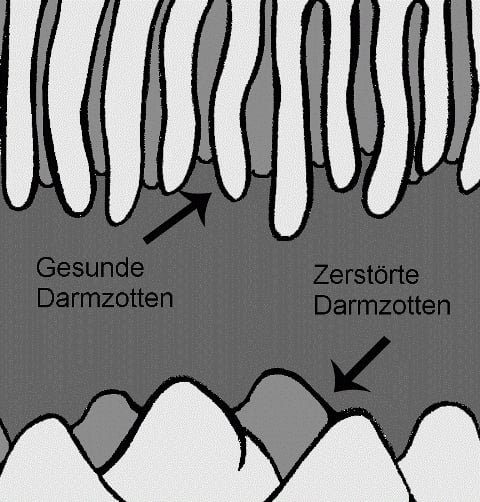 DF1a