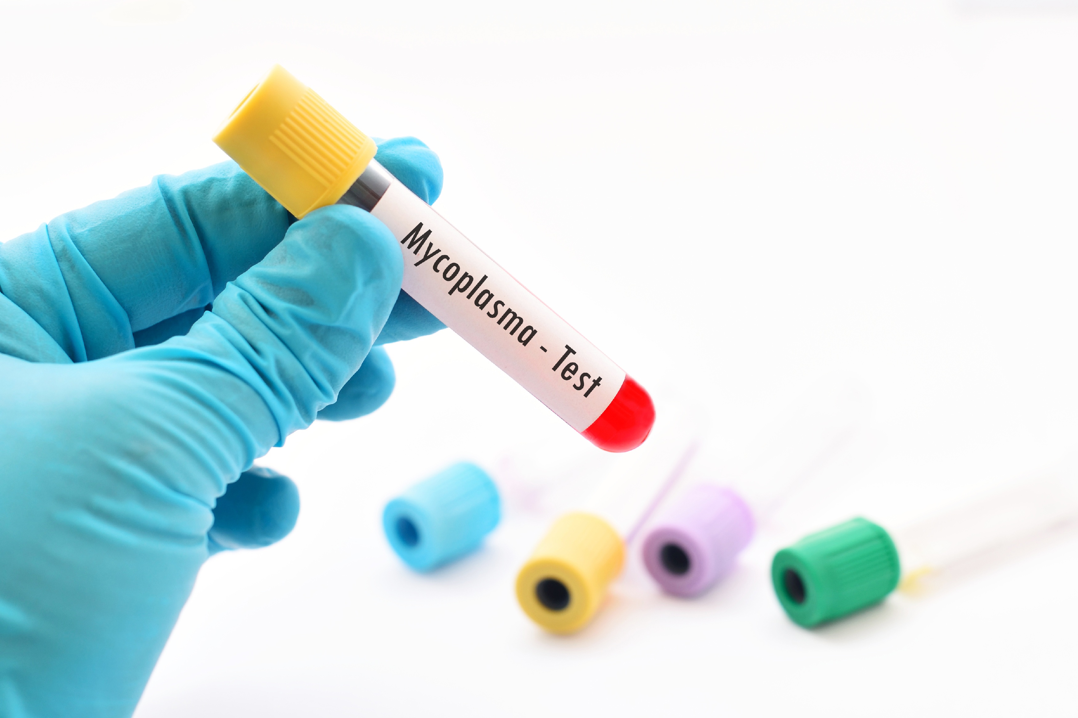 Mycoplasma test