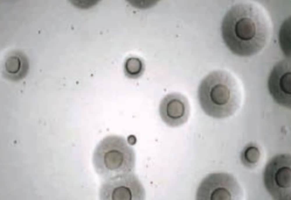 sindrome respiratorio bovino mycoplasma